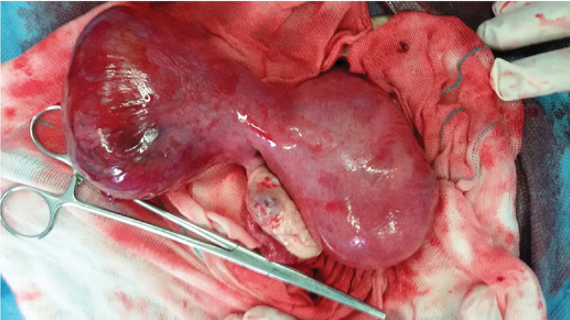 real uterus with baby