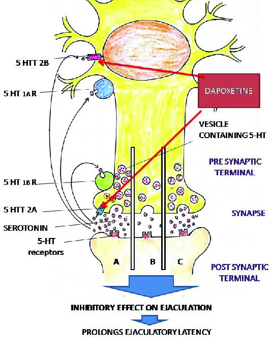 Premature ejaculation current concepts in the management A