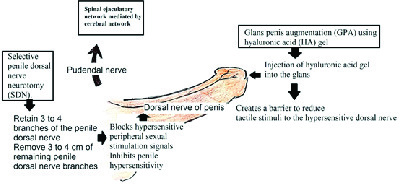 Premature ejaculation current concepts in the management A